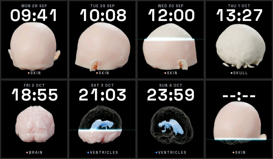 A watch face made from a CT scan of Ewan's head, peeling back skin, skull, brain and ventricles